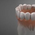 How Miami Dental Implants Can Restore Your Confidence in the Workplace