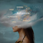 Understand Ketamine Treatment for Depression In Miami, Florida